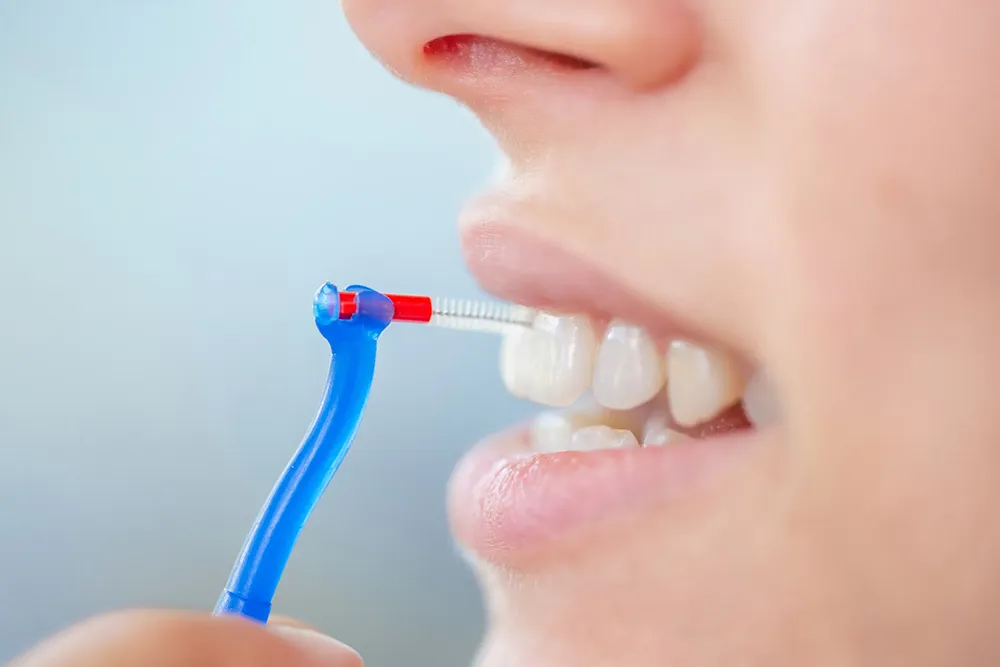 Ang Tamang Paraan ng Paggamit ng Interdental Brush